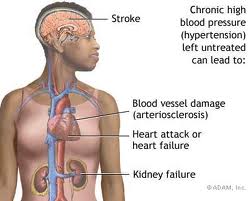 hipertenzija pedigre bolest diastolični krvni tlak visok
