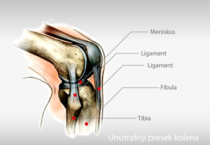 Povrede ligamenata kolena